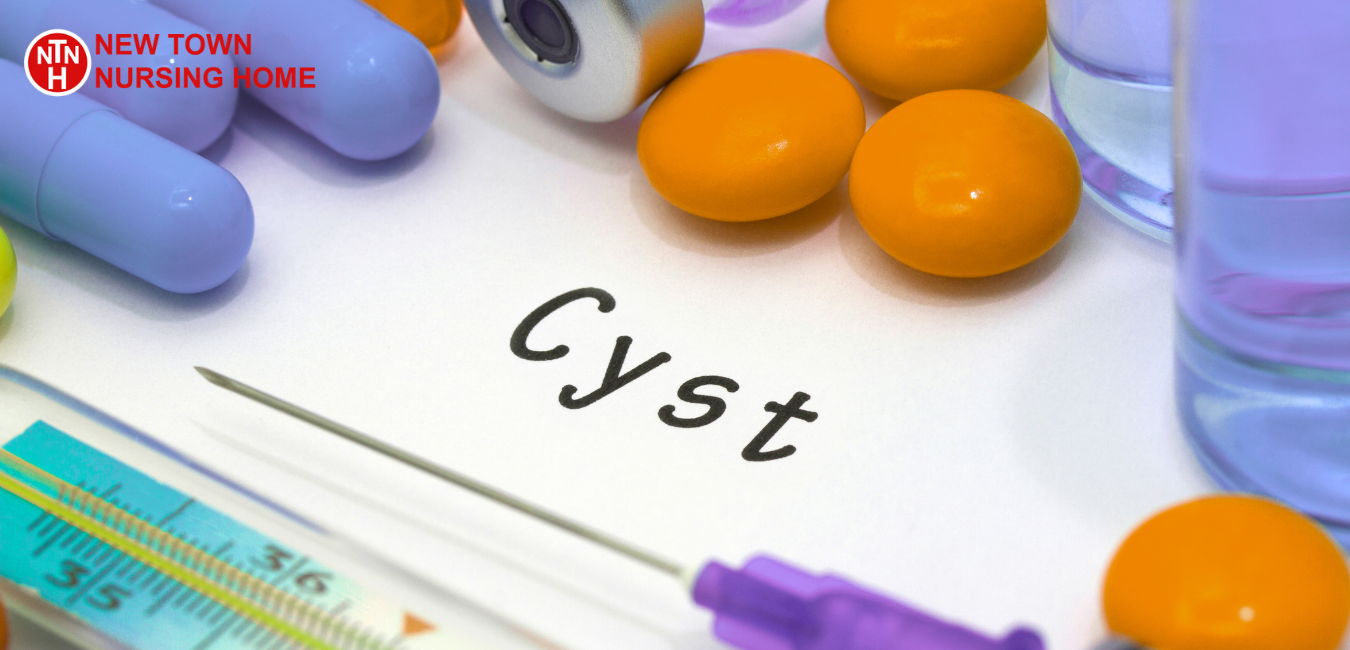Ovarian Cysts: Types, Symptoms & When They Need Attention